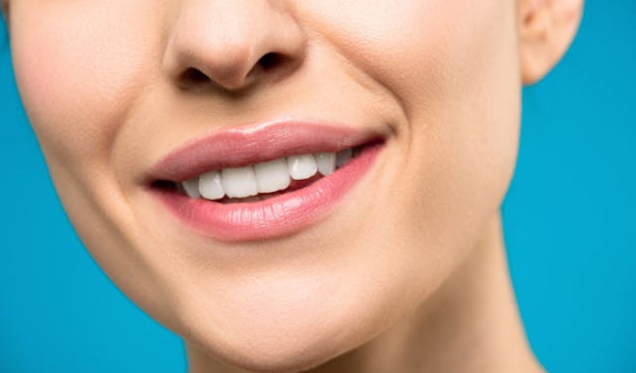 Carolina Faces Cosmetic Oral Surgery