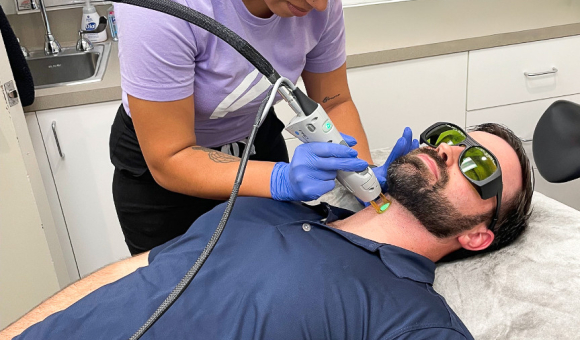 Carolinas Faces mens laser hair removal treatment on facial hair