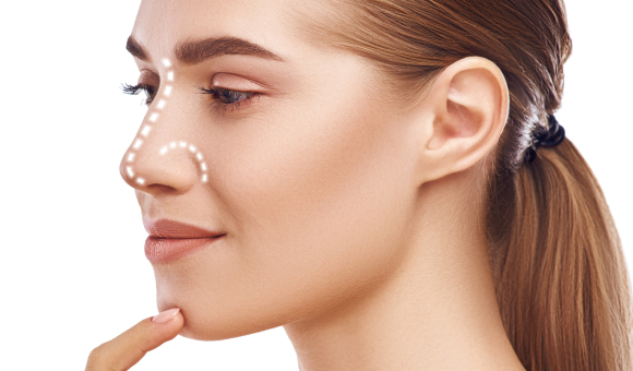a woman's face with markings on her nose, carefully planned for a rhinoplasty procedure to outline the areas of her nose