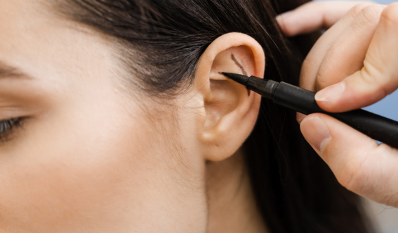 Close-up of a surgeon drawing markings on a woman's ear, planning for ear surgery