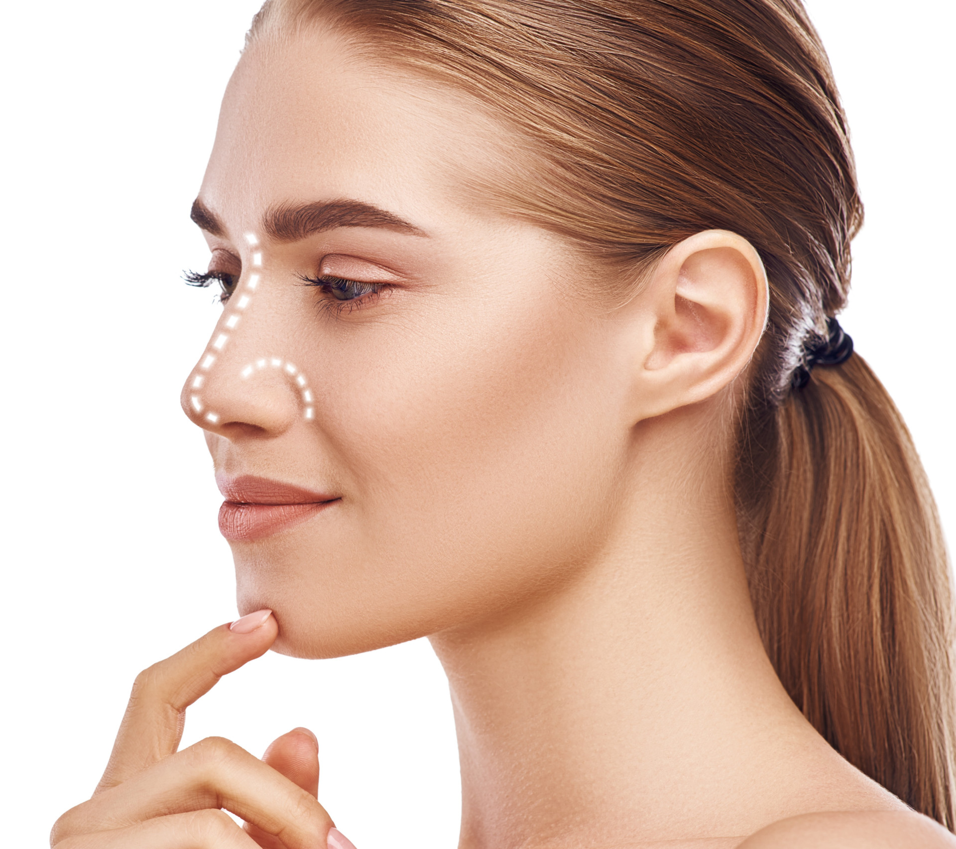 a woman's face with markings on her nose, carefully planned for a rhinoplasty procedure to outline the areas of her nose
