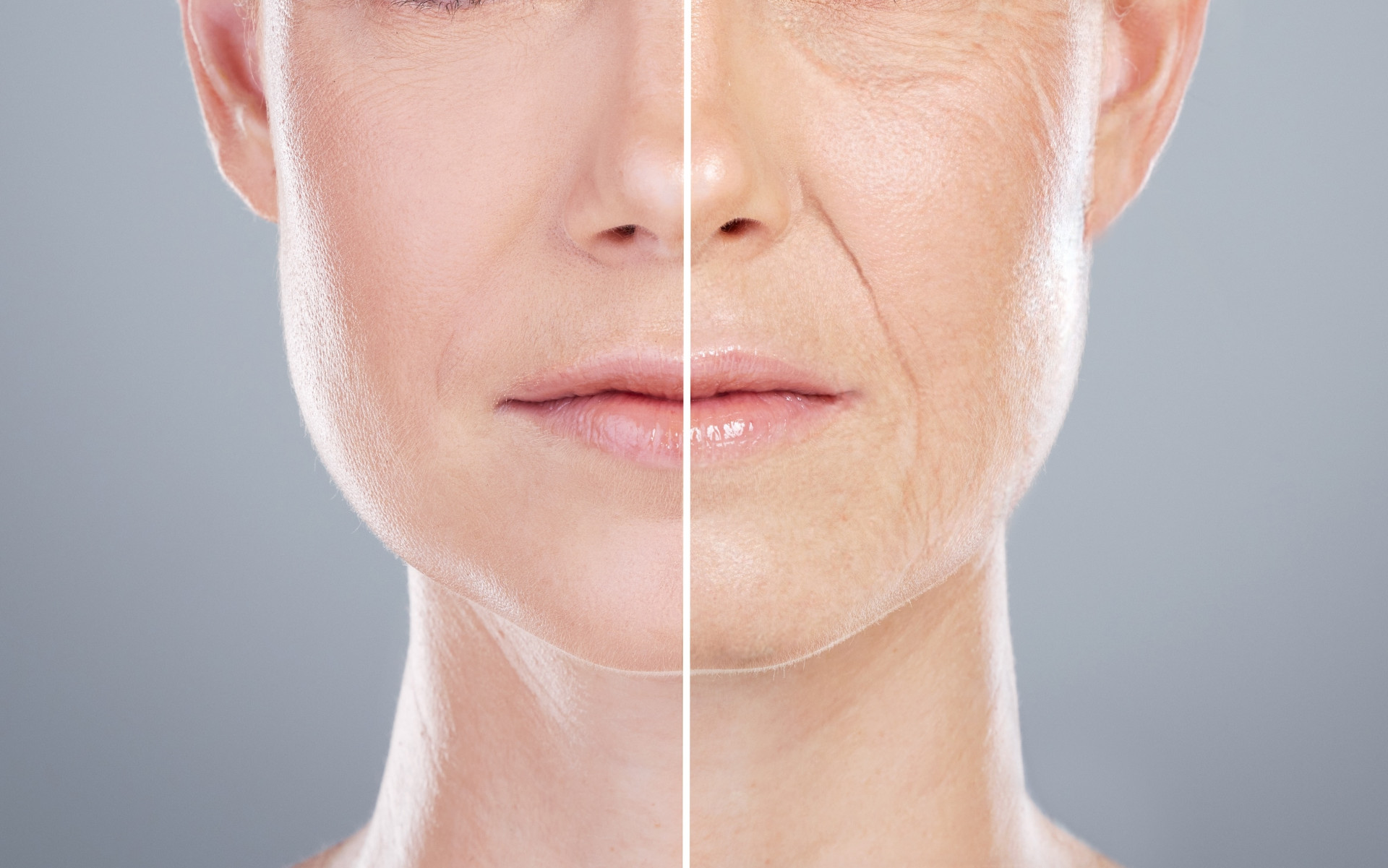 Before and after close-up of a woman's face, showing the transformation following a facelift